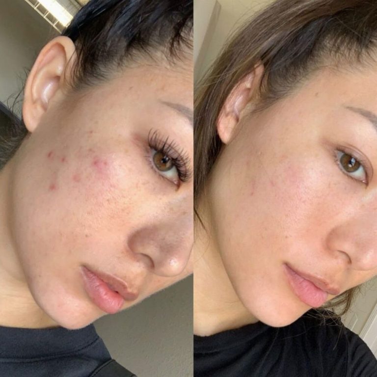 Paige Layne
Sales agent
★★★★★
Amazing facial service! My pores look smaller, and my face feels so clean and soft. The products smelled lovely and felt gentle. I noticed a difference in my complexion right away. Will return monthly!