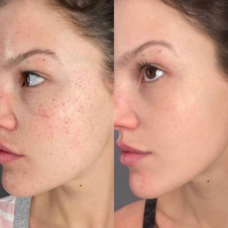 Steff Anie
Office staff
★★★★★
The facial left my skin refreshed and radiant. The spa environment was calming, and the therapist explained every step clearly. It was a pampering experience from start to finish. I loved every minute of it!